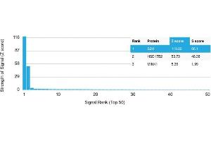 Analysis of Protein Array containing more than 19,000 full-length human proteins using Beta-2 Microglobulin Mouse Recombinant Monoclonal Antibody (rB2M/961).