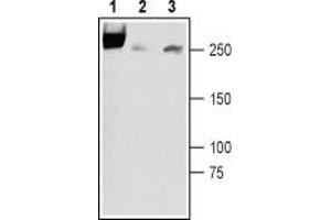 Western blot analysis of rat newborn brain lysates (lanes 1 and 3), rat adult brain membranes (lane 2): - 1,2. (SCN3A anticorps  (3rd Extracellular Loop, Domain 1))