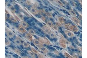 Detection of iPLA2 in Mouse Stomach Tissue using Polyclonal Antibody to Phospholipase A2, Calcium Independent (iPLA2) (PLA2G6 anticorps  (AA 481-702))
