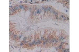 Figure. (P4HB anticorps  (AA 216-465))