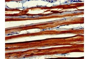 Immunohistochemistry of paraffin-embedded human skeletal muscle tissue using ABIN7160604 at dilution of 1:100 (MYBPC2 anticorps  (AA 739-1141))