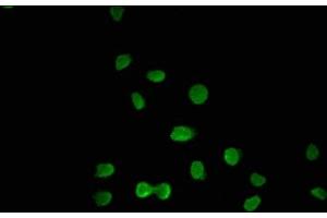 Immunofluorescence staining of A549 cells with ABIN7176586 at 1:100, counter-stained with DAPI. (GLIS3 anticorps  (AA 527-663))