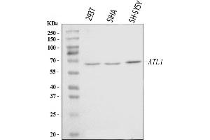 Western blot analysis of SPG3A/ATL1 using anti-SPG3A/ATL1 antibody (ABIN7603095).