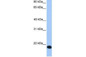 WB Suggested Anti-ZNF833P Antibody Titration:  0. (LOC401898 anticorps  (Middle Region))