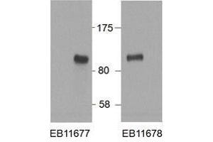 Western Blotting (WB) image for anti-Hypermethylated in Cancer 1 (HIC1) (AA 193-204) antibody (ABIN5868799) (HIC1 anticorps  (AA 193-204))