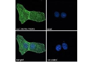 ABIN185158 Immunofluorescence analysis of paraformaldehyde fixed U2OS cells, permeabilized with 0. (PDZD2 anticorps  (N-Term))