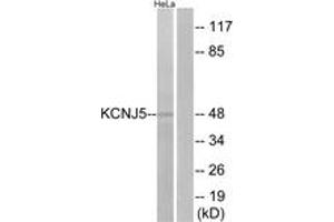 Western blot analysis of extracts from HeLa cells, using KCNJ5 Antibody. (KCNJ5 anticorps  (AA 370-419))