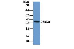 Figure. (FTL anticorps  (AA 1-175))