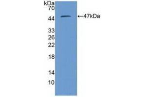 Detection of Recombinant PSMD13, Human using Polyclonal Antibody to Proteasome 26S Subunit, Non ATPase 13 (PSMD13)