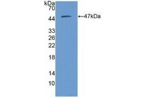 Detection of Recombinant PSMD13, Human using Polyclonal Antibody to Proteasome 26S Subunit, Non ATPase 13 (PSMD13) (PSMD13 anticorps  (AA 1-378))