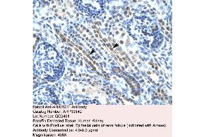 Human kidney (ANKRD11 anticorps  (N-Term))