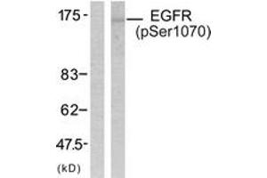 Western blot analysis of extracts from SK-OV3 cells treated with EGF, using EGFR (Phospho-Ser1070) Antibody. (EGFR anticorps  (pSer1070))