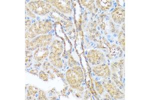 Immunohistochemistry of paraffin-embedded mouse kidney using Sec23AA Rabbit mAb (ABIN7270168) at dilution of 1:100 (40x lens). (SEC23A anticorps)