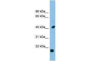 WB Suggested Anti-HSPB2 Antibody Titration: 0. (HSPB2 anticorps  (Middle Region))