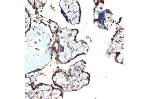 Immunohistochemistry of paraffin-embedded human placenta using  Rabbit mAb (ABIN7265406) at dilution of 1:100 (40x lens). (ATF5 anticorps)