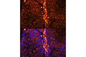 Immunofluorescence analysis of mouse testis using RBP1 Rabbit pAb (ABIN6129597, ABIN6146795, ABIN6146796 and ABIN6214136) at dilution of 1:100 (40x lens).