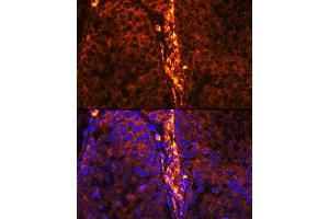 Immunofluorescence analysis of mouse testis using RBP1 Rabbit pAb (ABIN6129597, ABIN6146795, ABIN6146796 and ABIN6214136) at dilution of 1:100 (40x lens). (RBP1 anticorps  (AA 63-197))