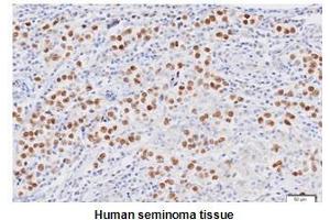 Paraffin embedded sections of human seminoma tissue were initrocelluloseubated with anti-human Nanog (1:50) for 2 hours at room temperature. (Nanog anticorps  (AA 1-154))