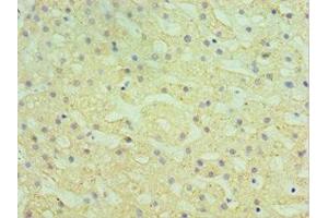 Immunohistochemistry of paraffin-embedded human liver tissue using ABIN7155969 at dilution of 1:100 (HYAL1 anticorps  (AA 136-435))