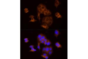 Immunofluorescence analysis of MCF7 cells using DTYMK Rabbit mAb (ABIN7266735) at dilution of 1:25 (40x lens). (DTYMK anticorps)