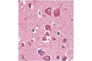 Immunohistochemistry (IHC) image for anti-PTEN Induced Putative Kinase 1 (PINK1) antibody (ABIN356391) (PINK1 anticorps)