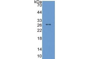 WB of Protein Standard: different control antibodies against Highly purified E.