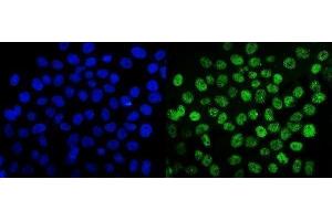 IF analysis of SUMO2/3 using anti-SUMO2/3 antibody (ABIN7600856). (SUMO2/3 anticorps  (AA 24-72))