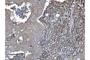 IHC analysis of EHD3 using anti-EHD3 antibody (ABIN7602777). (EHD3 anticorps  (C-Term))