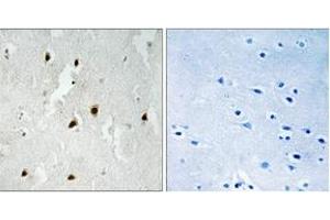 Immunohistochemistry analysis of paraffin-embedded human brain, using FOXO4 (Phospho-Ser262) Antibody. (FOXO4 anticorps  (pSer262))