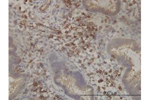 Image no. 1 for anti-Pantothenate Kinase 2 (PANK2) (AA 205-260) antibody (ABIN599308) (PANK2 anticorps  (AA 205-260))