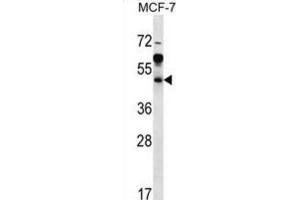 Western Blotting (WB) image for anti-ADP-Ribosylation Factor Interacting Protein 1 (ARFIP1) antibody (ABIN2997067) (ARFIP1 anticorps)