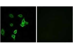Immunofluorescence analysis of A549 cells, using KANK2 Antibody. (KANK2 anticorps  (AA 351-400))