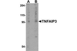 Western blot analysis of TNFAIP3 in rat lung tissue lysate with this product at (A) 1 and (B) 2 μg/ml.