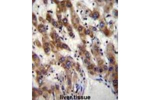 Immunohistochemistry (IHC) image for anti-PHD Finger Protein 20 (PHF20) antibody (ABIN2996558) (PHF20 anticorps)