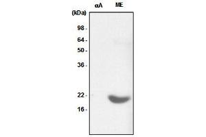 Recombinant crystallin alpha A (alphaA) and the extract of mouse eye (ME) were resolved by SDS-PAGE, transferred to PVDF membrane and probed with anti-human crystallin alpha B antibody (1:1,000). (CRYAB anticorps)