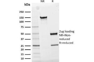 SDS-PAGE Analysis Purified CD25 Mouse Monoclonal Antibody (IL2RA/2395).