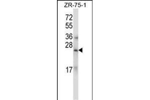 RLN1/RLN2 Antibody (C-term) (ABIN657785 and ABIN2846759) western blot analysis in ZR-75-1 cell line lysates (35 μg/lane). (RLN1,RLN2 anticorps  (C-Term))