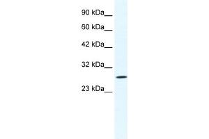 WB Suggested Anti-CLIC1 Antibody Titration:  1. (CLIC1 anticorps  (N-Term))