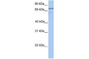 WB Suggested Anti-TGM7 Antibody Titration:  0. (Transglutaminase 7 anticorps  (C-Term))