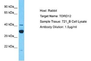 Host: Rabbit Target Name: TDRD12 Sample Type: 721_B Whole Cell lysates Antibody Dilution: 1. (TDRD12 anticorps  (C-Term))