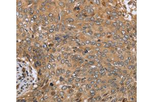 Immunohistochemistry (IHC) image for anti-C-Type Lectin Domain Family 16, Member A (CLEC16A) antibody (ABIN2433461) (CLEC16A anticorps)