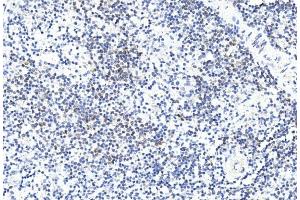 Immunohistochemical analysis of paraffin-embedded human spleen section using GREMLIN Antibody (C-term) (ABIN390078 and ABIN2840598). (GREM1 anticorps  (C-Term))