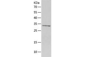 Western Blotting (WB) image for Insulin-Like Growth Factor Binding Protein 3 (IGFBP3) (AA 28-291) protein (His tag) (ABIN7123461) (IGFBP3 Protein (AA 28-291) (His tag))
