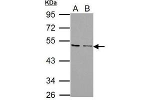 WB Image Sample (30 ug of whole cell lysate) A: PC-3 B: U87-MG 10% SDS PAGE antibody diluted at 1:1000 (CXCR7 anticorps)
