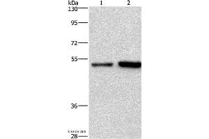 Western blot analysis of Hela and Jurkat cell, using SYT4 Polyclonal Antibody at dilution of 1:700 (SYT4 anticorps)