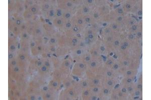 Detection of C3 in Human Liver Tissue using Polyclonal Antibody to Complement Component 3 (C3) (C3 anticorps  (AA 1000-1326))