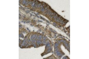 IHC analysis of REA/PHB2 using anti REA/PHB2 antibody (ABIN7599240).