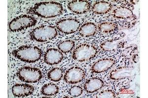 Immunohistochemistry (IHC) analysis of paraffin-embedded Human Colon, antibody was diluted at 1:100.