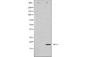 Western blot analysis of p18 INK expression in Cos7 cell extract.