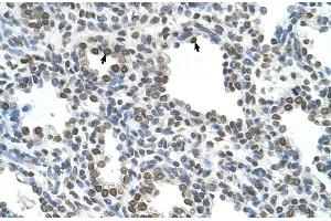 Rabbit Anti-NKD1 Antibody  Paraffin Embedded Tissue: Human Lung Cellular Data: Alveolar cells Antibody Concentration: 4. (NKD1 anticorps  (N-Term))
